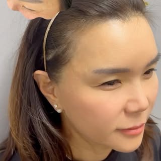 Check out our hairline smp 1st session💡
Experience a noticeable transformation even after just the 