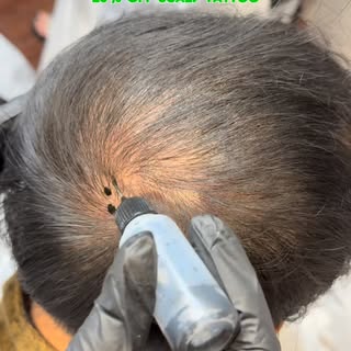 This Christmas, enjoy the holidays with a full scalp by filling it in with ScalpAir! Tattoo your or 