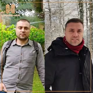 Unlock confidence with Hair Transplants in Turkey! 🌟✨ Our state-of-the-art clinics offer natural-lo