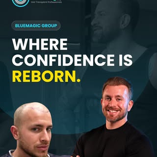 BlueMagic Group: WHERE CONFIDENCE IS REBORN.
It’s more than hair restoration, it’s transformation.

