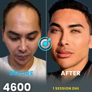 Same person. New confidence.
This is what a few months and the right team can do. Real results, real