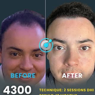 Real results, real confidence.
From thinning to thriving swipe to see the transformation.
Ready to s