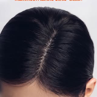 맘모스 헤어라인의원은 프라이빗한 공간에서 모발이식과 재생 치료를 함께 제공하는 탈모·항노화 특화 의료기관입니다.

모발이식센터는 대표원장 1인이 상담부터 디자인, 채취, 식모까지 