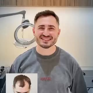 Clinicana implant de par .Tot mai multi pacienti aleg Clinicana in vederea efectuarii unui implant d