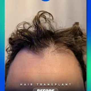 The difference speaks for itself ✨

Swipe to see this hair ransformation.

🦋 Ready for your own jou