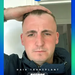 Real transformation. Real results. 🦋

Swipe to see the transformation.

No filters, no tricks, just