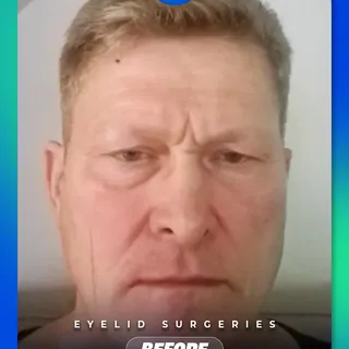 Brighter eyes. Refreshed look. ⭐

Swipe to see the transformation. 

A subtle change can make a rema
