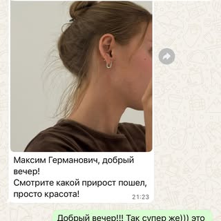 ✨ ВЕЩИ, КОТОРЫЕ ДЕЛАЮТ НАШ ДЕНЬ СВЕТЛЫМИ ✨

Сегодня получил фото от пациентки — и! 🥹💖 💪 
Это не п