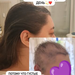 Волосы — это не про «раз и навсегда» 💫 
Это про путь, доверие и заботу о себе 🌱 

Знаете, в трихол