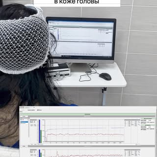 📄 ЗАКЛЮЧЕНИЕ
По результатам неинвазивной оценки микроциркуляторно-тканевой системы (МТС) волосистой