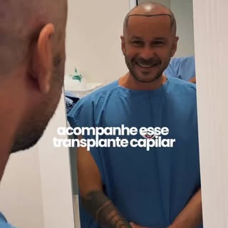 Acompanhe de perto a transformação desse transplante capilar! 

Do planejamento ao procedimento, cad