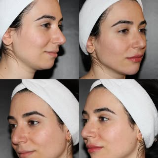 Couples therapy… but make it cosmetic. 💉✨
Dr. Nosrati convinced her husband to try Botox and laser 