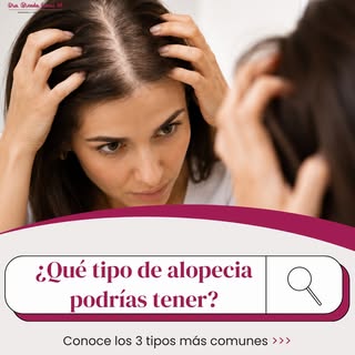 🤔 ¿Sabías que la caída del cabello
puede tener diferentes causas?

😰 El estrés, ⚖️ los cambios hor