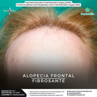 🩺✨ ¿Tienes “caspa” que no mejora… o estás viendo zonas enrojecidas, costras, dolor o caída?
La infl