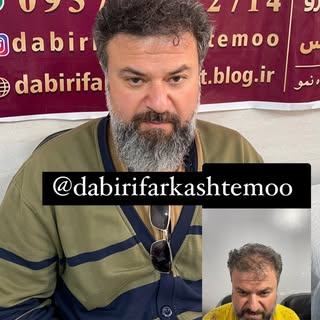 #دبیریفر#کاشتمو #حیدرشناس#مزوتراپی_مو #خوزستان_اهواز_ماهشهر_امیدیه_آبادان_خرمشهر_مینوشهر_سربندر_رامش