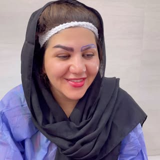 #اابرو‌#کاشت -ابرو #اهواز #زیبایی-مو #کاشتمو#دبیریفر #حیدرشناس