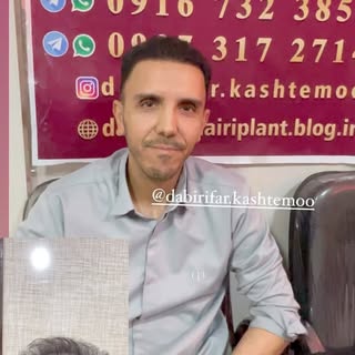 تراکم بالا ‌طبیعی 😍😍#دبیریفر #کاشتمو #اهواز