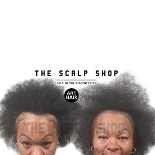 Maisha has a head full of hair, except along her edges. Lace front wigs that were glued down to her 