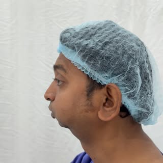 TMJoint Ankylosis patient - Healing in progress @richardsons_face_hospitals 

#richardsons #beforean