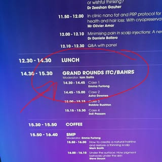 Excited to now have my own dedicated section of the day at the British Association of Hair Restorati