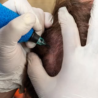 Struggling with thinning hair? Scalp Micropigmentation could be your secret to confidence and a full