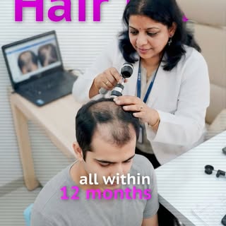 Are you waiting for your hair fall to magically stop on its own? Here’s why that delay is costing yo