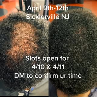 Hair Loss treatments, hair consultation, quick weaves, Sew ins… restore your confidence with your fi