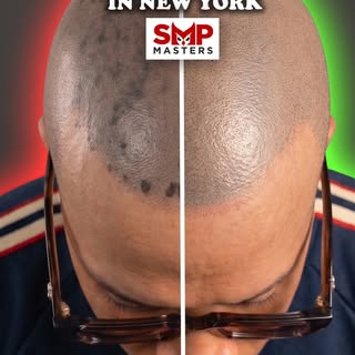 SMP Disaster Fixed - Best SMP Repair in New York 🗽

Severe SMP correction done for a client with bo