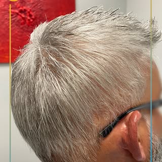 De papá a "Papazote". ¿Qué mejor regalo? 🎁💇🏽‍♂️✨

¡Agenda tu cita! 📞 787.590.4062

#JJHairReplac