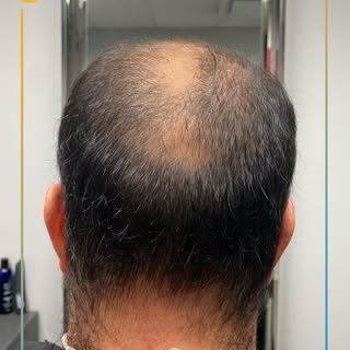 Cada detalle cuenta. Te ayudamos a recuperar tu cabello con resultados de verdad ¡Agenda tu cita hoy