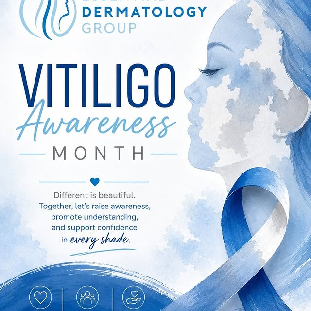 Every skin tells a beautiful story.

Vitiligo is a chronic skin condition that causes patches of ski