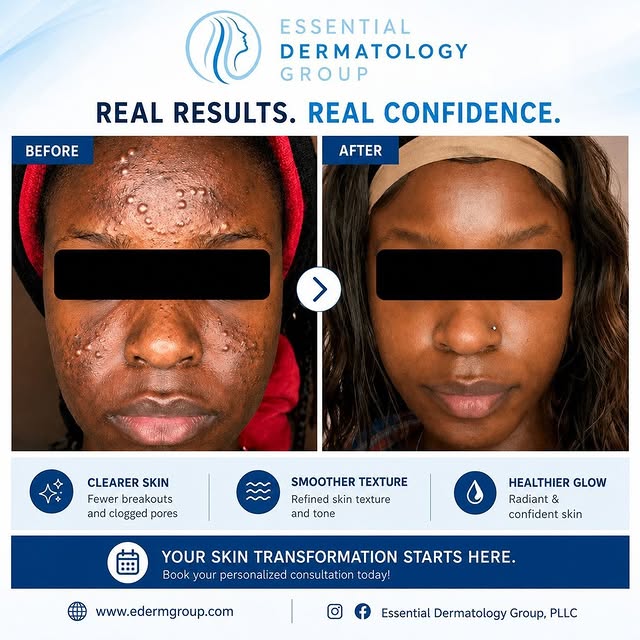 ✨ Clearer skin. Renewed confidence. Life-changing results. ✨

This incredible transformation is proo