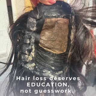 Hair loss deserves more than good intentions.

It deserves proper education, experience, and a genui