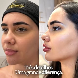 ✨ Três detalhes. Uma grande diferença.

Ela se incomodava com as olheiras, com o lábio superior mais