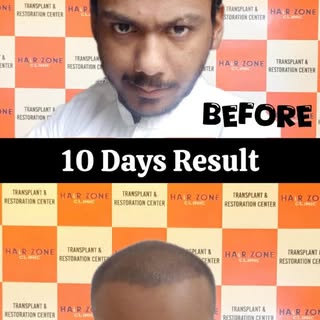 If hair loss is controlling how you look, dress, and feel — this isn’t ‘normal’.
This is fixable.
Pe