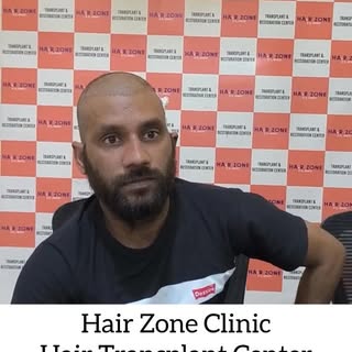 From hair loss worries to confidence smiles 😊
Our patient shares their honest review after a succes