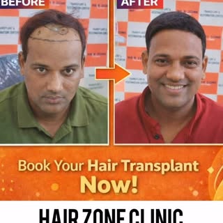 Restore your confidence with advanced hair transplant solutions ✨

At Hair Zone Clinic, we offer saf