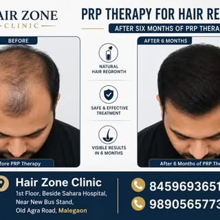 Call- 8459693651
For appointment.

Hair Transplant• Hair PRP • Hair GFC

Experience natural-looking,