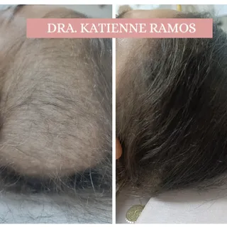 Que maravilha, pode entregar resultados como esse aos meus pacientes!

Recuperar a autoestima é um p