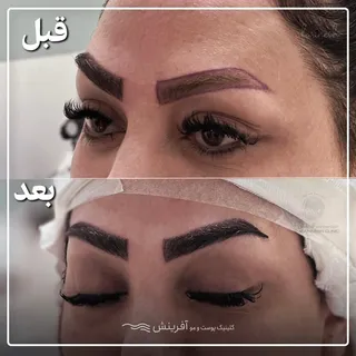کاشت ابرو با تراکم بالا و خواب کاملا طبیعی 
در کلینیک آفرینش
#کاشت #کاشت_ابرو #کاشت_مو
