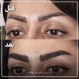 کاشت ابرو با آفرینش 
یعنی تراکم بالا
طراحی دلخواه شما 
خواب طبیعی ابروها

#کاشت_ابرو #کاشت_مو
#کاشت 
