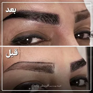 تجربه کاشت ابرو در مجهزترین کلینیک کاشت تهران
آفرینش کاشت 
آفرینش یک زیبایی

#کاشت_تهران #کاشت #ابرو