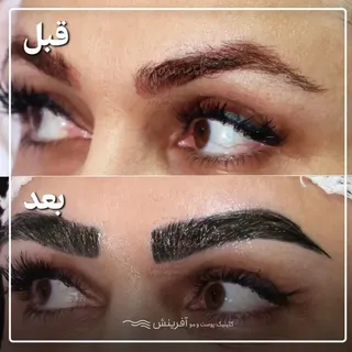 مقایسه با شما ✨✨✨
کاشت با این کیفیت و تراکم 
هیچ جا به جز آفرینش ممکن نیست 
#کاشت_تهران #کاشت_ابرو #