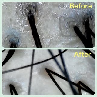 頭皮の毛穴詰まり😱

こんにちは🌞
アクティヘアクリニック安城店です

髪の毛がよく抜ける
髪が細くなったように感じる
頭皮地肌が目立ってきたように感じる

このようなお悩みの方
もしかしたら頭皮
