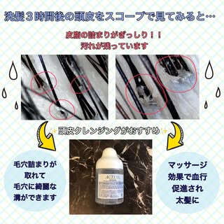 洗髪3時間後の頭皮

こんにちは！
アクティヘアクリニック安城店です😌

お客様の洗髪3時間後の頭皮をスコープで見てみると👀

毛穴に皮脂詰まりがぎっしり‼️
しっかり洗っていても落としきれていな