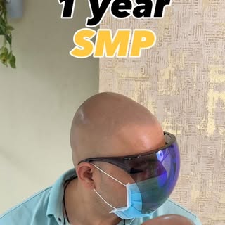 🔥 1 YEAR HEALED SCALP MICROPIGMENTATION RESULT 🔥

No filters. No enhancements. Just a beautifully 