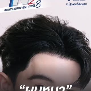 นวัตกรรมใหม่ N28 #เกศาผมหนาสุขภาพดี
.
ปลูกผมไม่จำเป็นต้องแพง แต่ต้องรักษาให้ถูกวิธี 
นวัตกรรมการรักษ