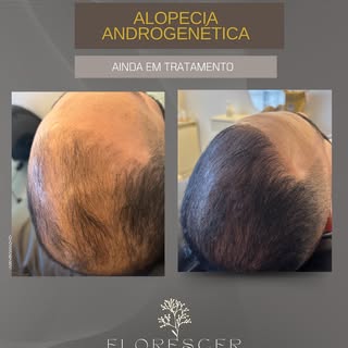 - A transformação de um senhor para um jovem🌸 é sobre isso.

Vamos Florescer mais!?🔥
.
.
.
.
#tran