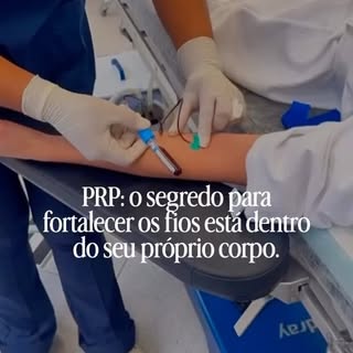 O Plasma Rico em Plaquetas (PRP) é um tratamento que utiliza os próprios fatores de crescimento do p