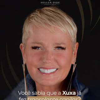 Em 2025, Xuxa Meneghel revelou ao Brasil que vivia com alopecia androgenética, condição hereditária,